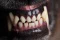 Paso Robles child attacked by pit bull