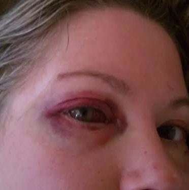 Woman sues for $10M, claims developer beat her repeatedly