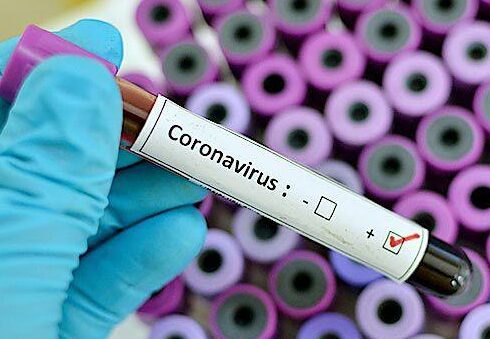 First confirmed case of coronavirus in Santa Barbara County